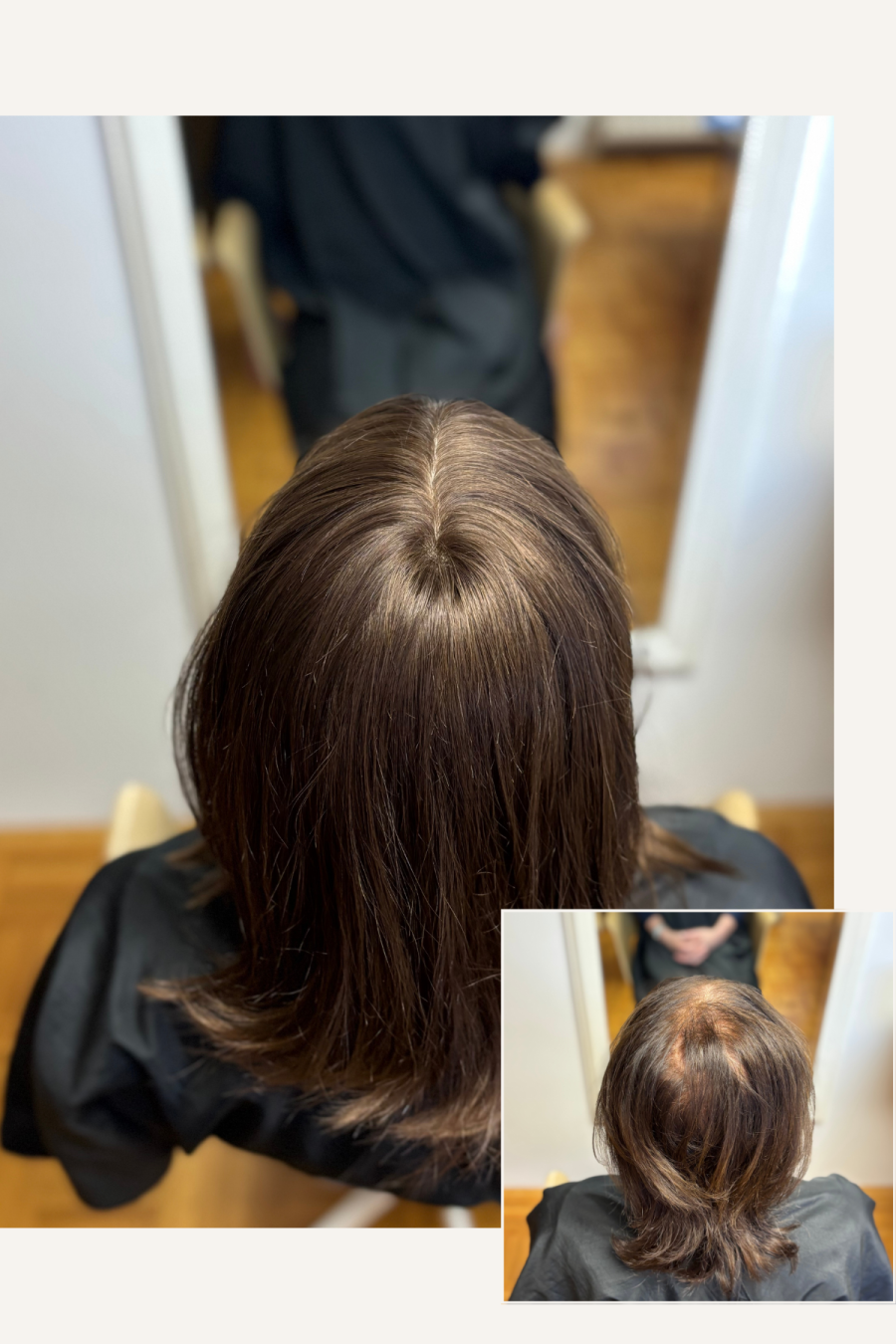 lasni vložek iz naravnih las redčenje na temenu