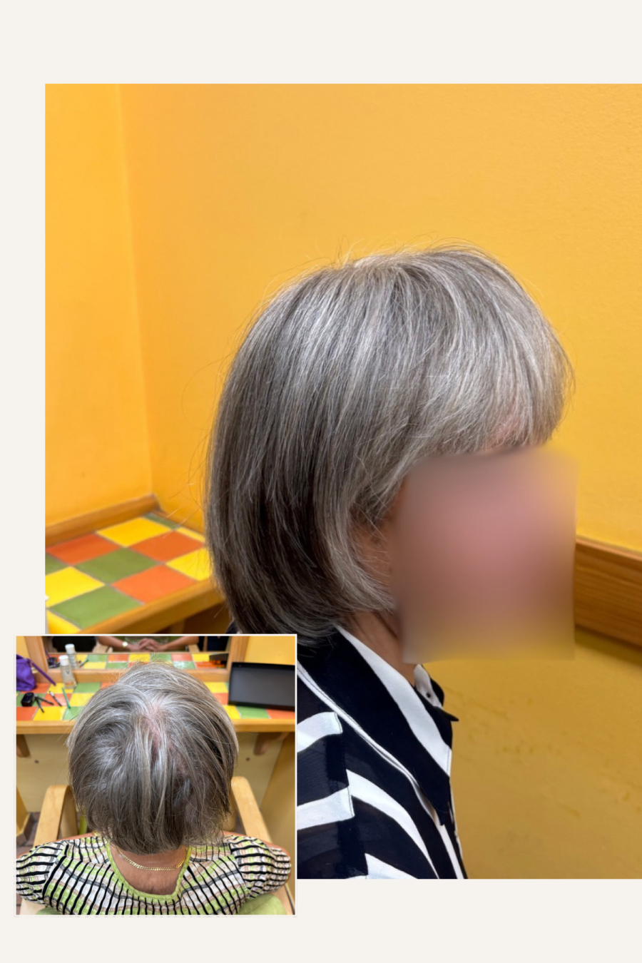 izguba volumna in lasulja iz naravnih las