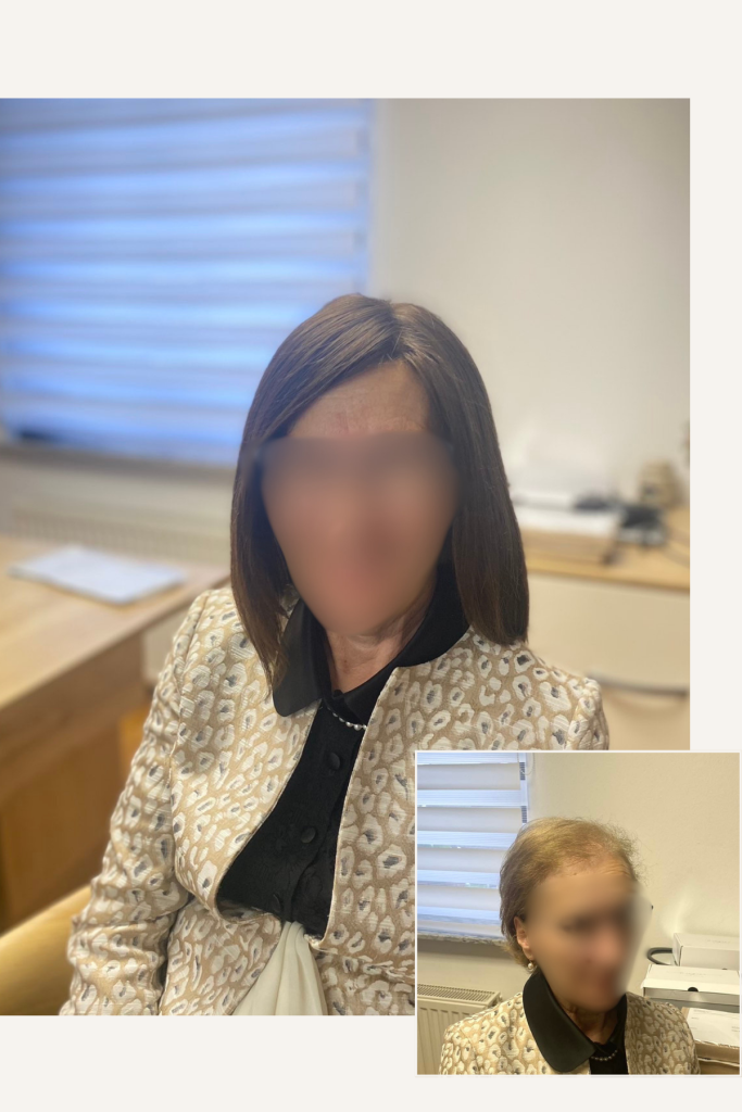 lasulja iz naravnih evropskih las redčenje po lasišču naraven rezultat brez vidnih prehodov