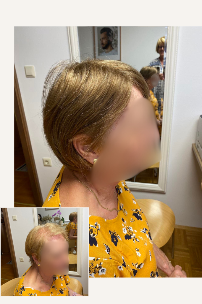 lasni vložek naravni lasje naraven rezultat